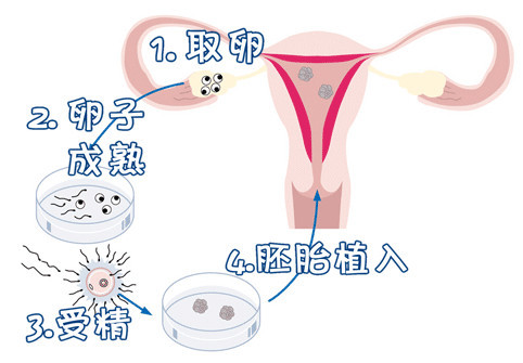 遗传咨询专家